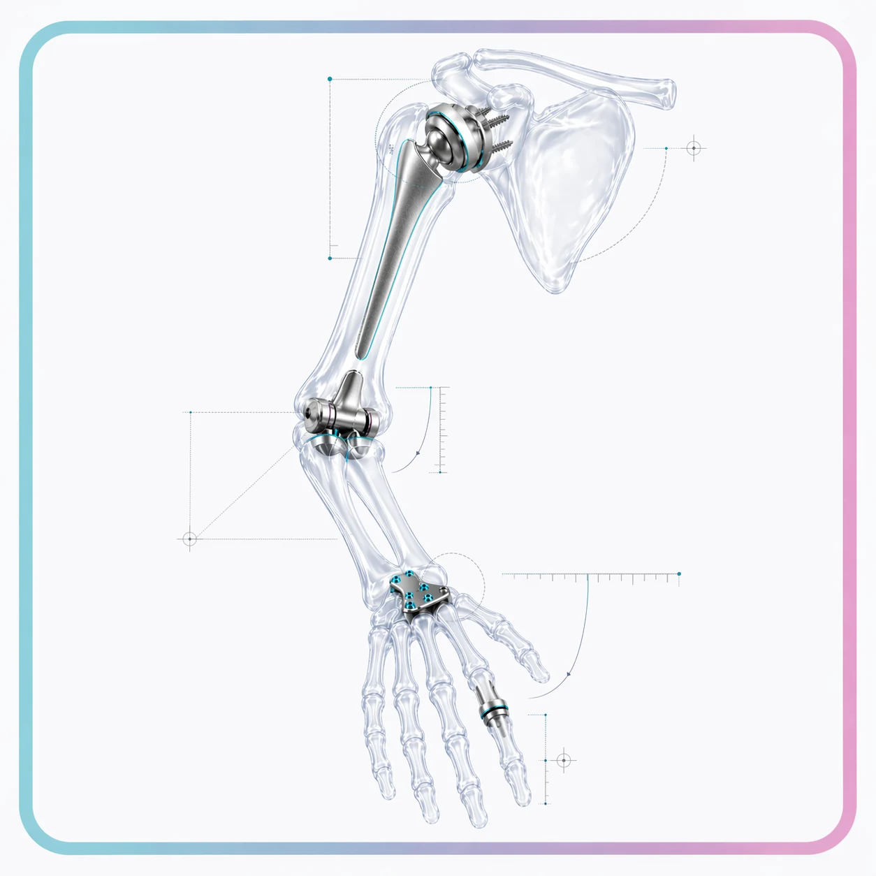 Upper extremities